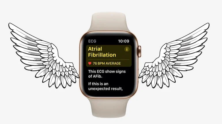 Apple Watch - ingerul tau pazitor