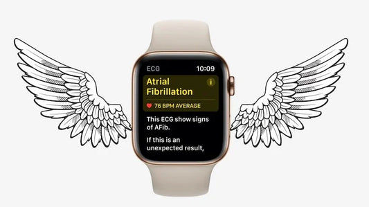 Apple Watch - ingerul tau pazitor