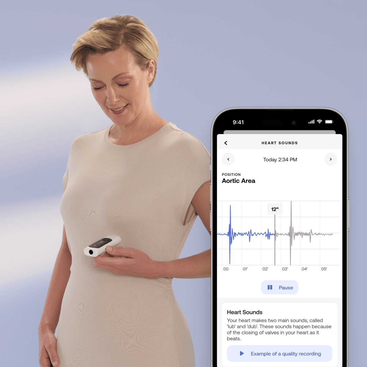 Withings Beam-O - Dispozitiv MultiScan 4 in 1 de evaluare a sanatatii (termometru, EKG, SPO2, stetoscop digital) - iSTYLE RO