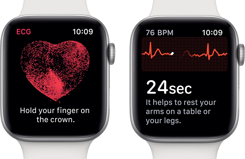 apple watch alb pe fundal alb